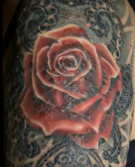 Bild Tattoo-Rose mit Granulomen